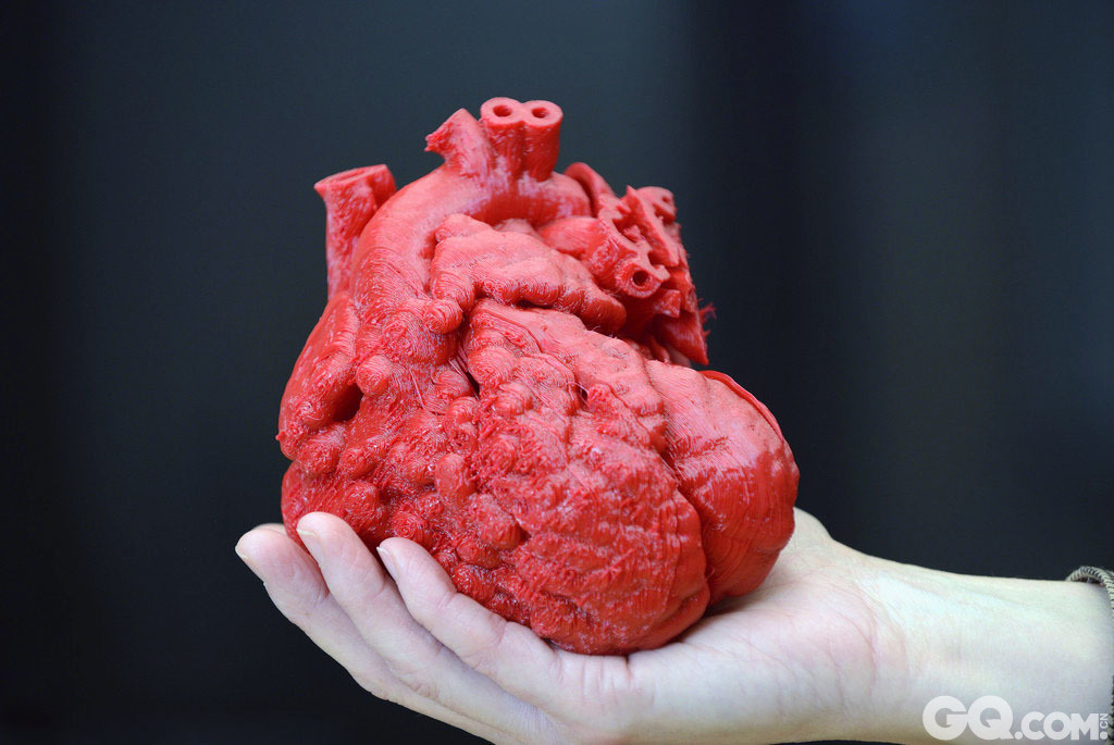 2014年2月25日，在美国肯塔基州的Kosair儿童医院，心脏外科医生Erle Austin在对一个患有心脏病的幼儿进行复杂的手术之前，用3D打印的模型规划和实验，保障了手术的成功完成。

Roland Lian Cung Bawi是一个14个月大的男孩，出生时就发现有心脏问题：心脏上有个孔，以及主动脉和肺动脉错位。他无法入睡，并呼吸困难。

先天性心脏缺陷是出生缺陷中最常见的类型，每年有近1%的新生婴儿有此类问题。造成该缺陷的原因是复杂多样的，对身体影响的严重程度也有很大的差别。